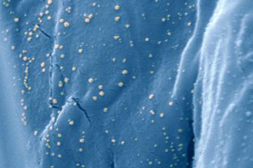 Scanning electron microscope image of silver nanoparticles on the surface of cotton.